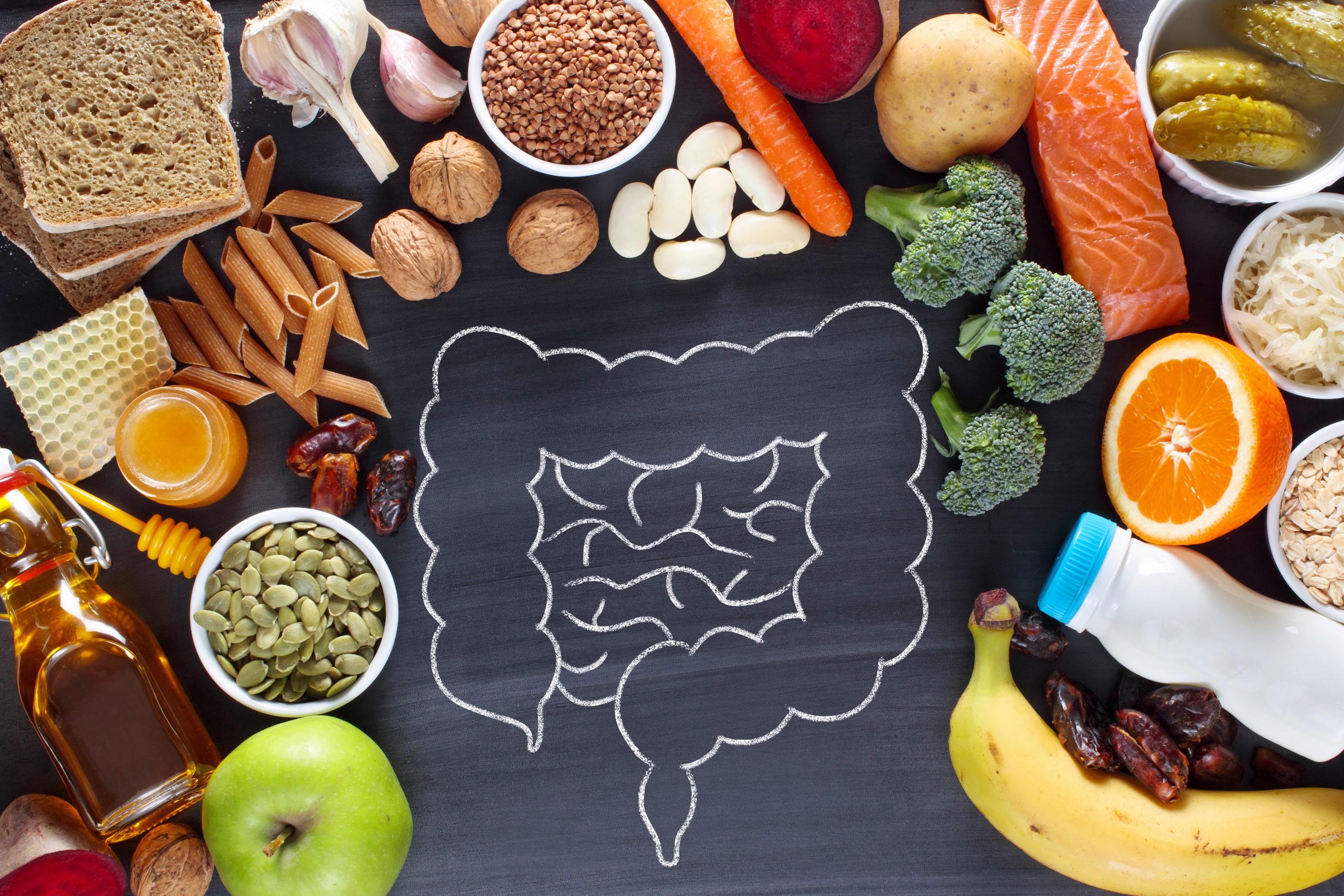 What is Diverticular disease? What can I eat?